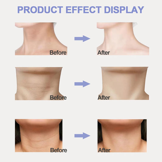 Tighten & Lift Neck Creams | Anti-Sagging & V-Line Firming Treatment