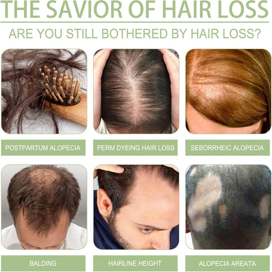 OUHOE Original Adivasi Hair Oil | Herbal Growth, Anti-Fall & Root Strength