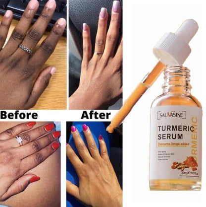 Beauty Lights Turmeric Serum | Dark Spot Corrector & Glow