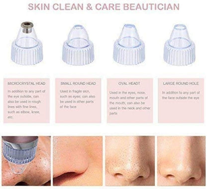 Pore Cleaning Devices & Blackhead Vacuums | Deep Facial Cleansing