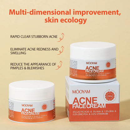 Mooyam Acne Face Cream (Original) | Blemish Clearing & Oil Control Treatment
