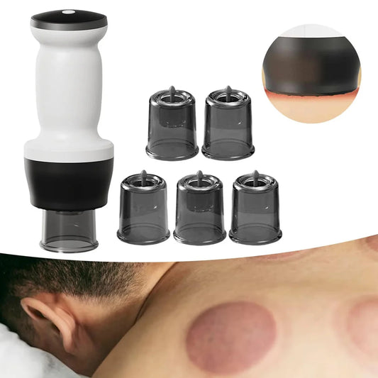 Intelligent Electric Cupping Massager | Heating, Scraping & Pain Relief