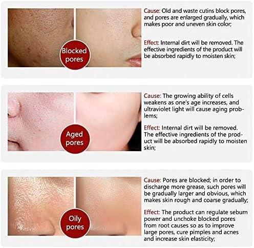 LANBENA Original Pore Solution Serum | Minimizing, Tightening & Blackhead Removal