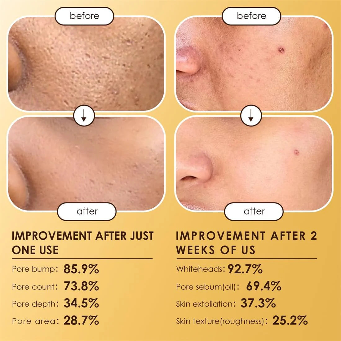 Moolinse Peel Shot P5 Exfoliant Ampoule (2-Pack) | Pore Clearing & Brightening