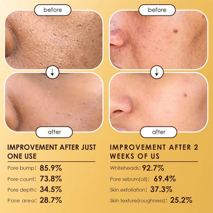 Moolinse Peel Shot P5 Exfoliant Ampoule (2-Pack) | Pore Clearing & Brightening