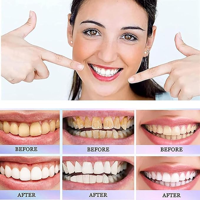 Oralhoe Nicotinamide Dazzle White Toothpaste | Stain Removal & Fresh Breath