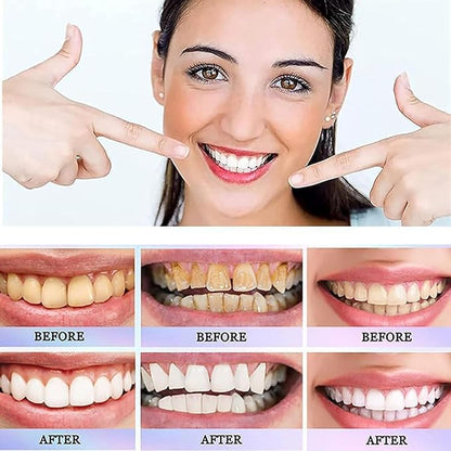 Oralhoe Nicotinamide Dazzle White Toothpaste | Stain Removal & Fresh Breath