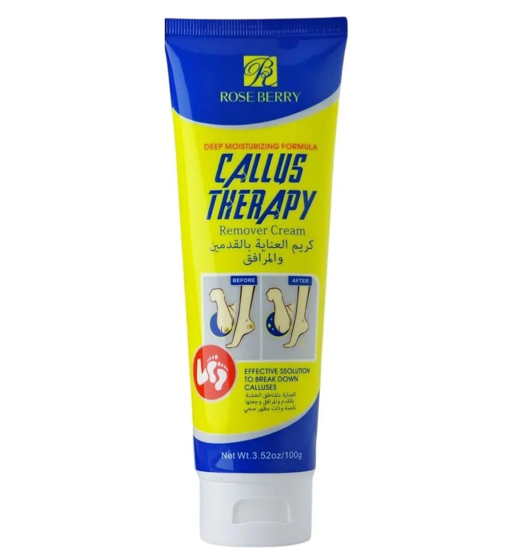 Rose Berry Original Callus Remover Cream | Soft Feet Therapy