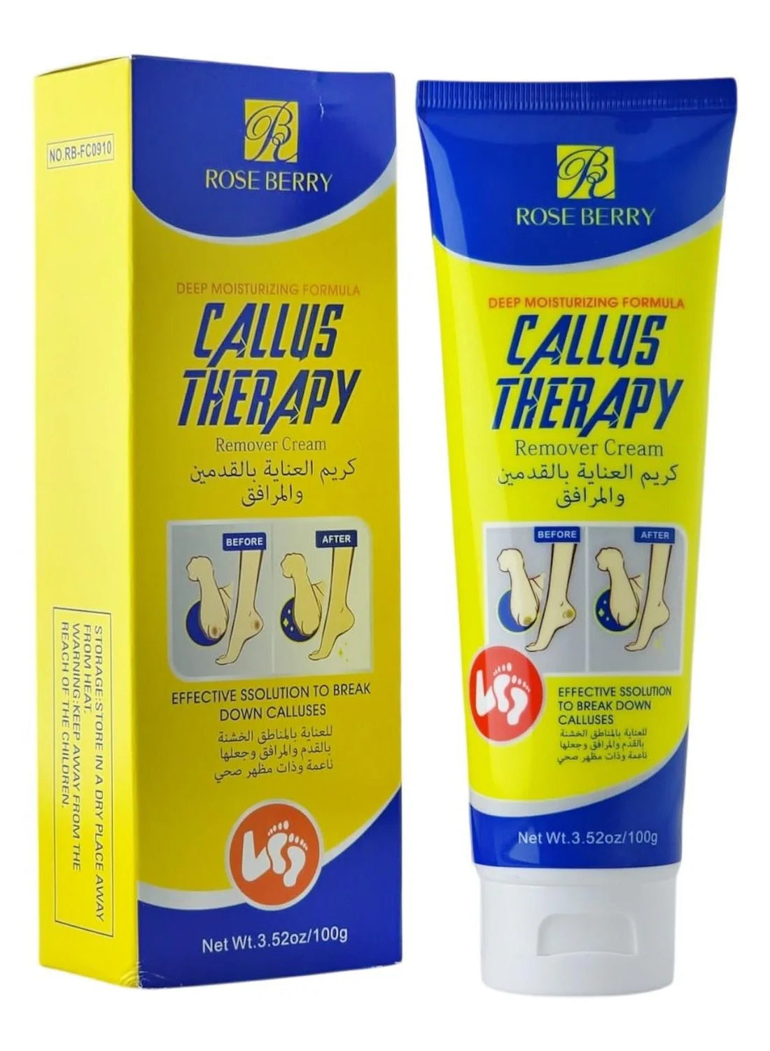 Rose Berry Original Callus Remover Cream | Soft Feet Therapy