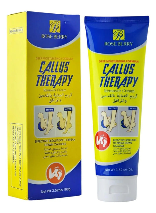 Rose Berry Original Callus Remover Cream | Soft Feet Therapy