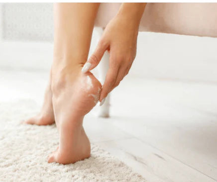 Rose Berry Original Callus Remover Cream | Soft Feet Therapy