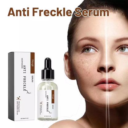 Anti Freckle Serum (Original) | Dark Spot Correction & Pigmentation Treatment