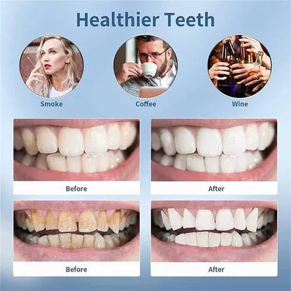 Smart Ultra-Sonic Teeth Cleaner | Home Tartar & Plaque Remover