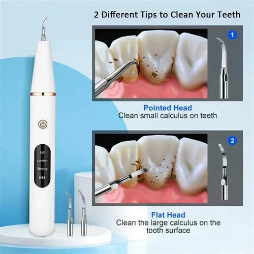 Smart Ultra-Sonic Teeth Cleaner | Home Tartar & Plaque Remover