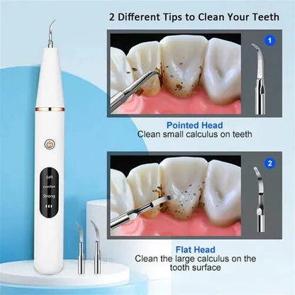 Smart Ultra-Sonic Teeth Cleaner | Home Tartar & Plaque Remover