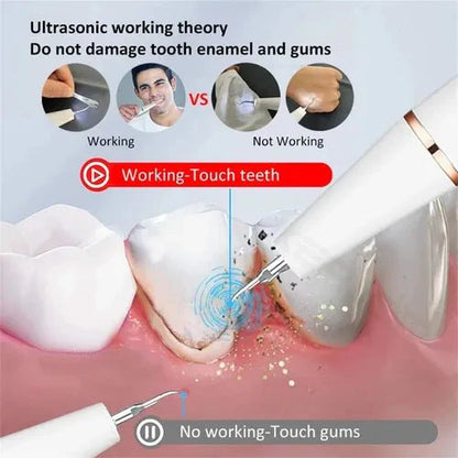 Smart Ultra-Sonic Teeth Cleaner | Home Tartar & Plaque Remover