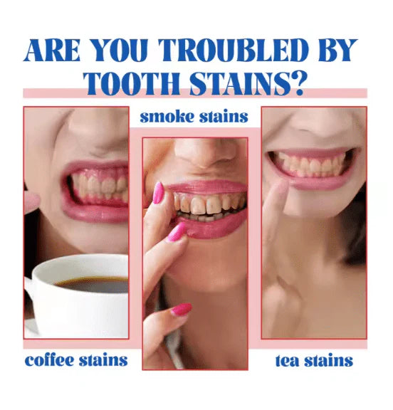 SP-6 Ultra Whitening Toothpaste (Original) | Stain Removal & Dazzling Brightness