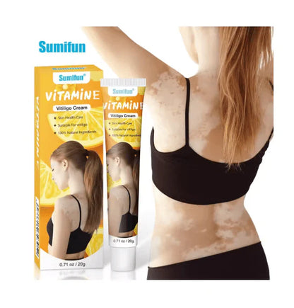 Sumifun Vitiligo Care Cream (Original) | Reduces White Spots & Improves Pigmentation
