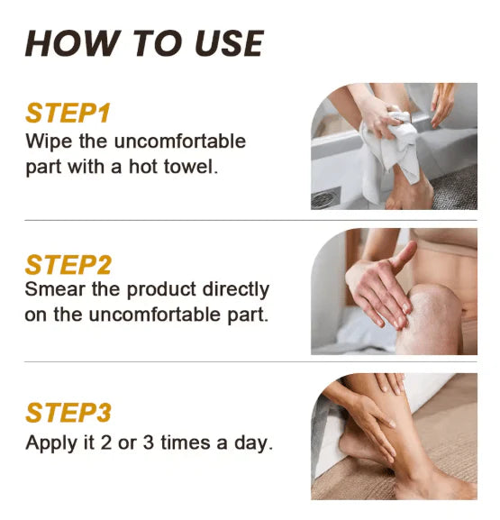 Sumifun Vitiligo Care Cream (Original) | Reduces White Spots & Improves Pigmentation