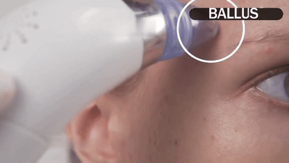 Pore Cleaning Devices & Blackhead Vacuums | Deep Facial Cleansing